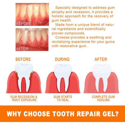 Teeth Repair Deep Cleaning Teeth Yellow Teeth Stain Tartar Care Gum Oral Care - Cruish Home