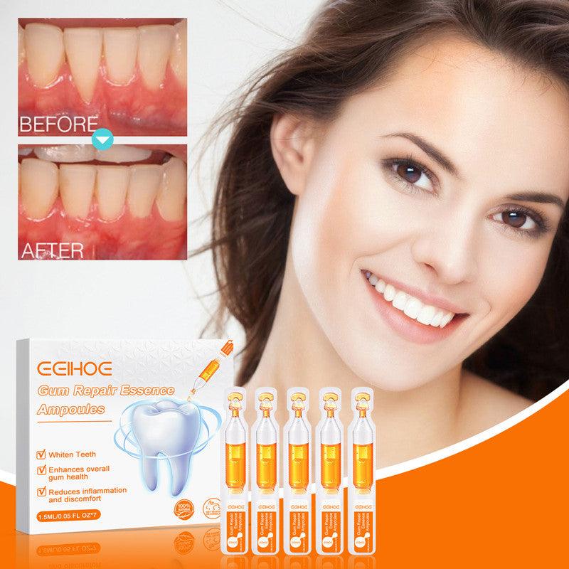 Teeth Repair Deep Cleaning Teeth Yellow Teeth Stain Tartar Care Gum Oral Care - Cruish Home