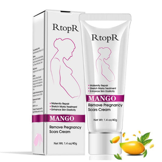 Natural Mild Non-irritating Mango Remove Stretch Mark Cream For Pregnancy Repair Scar Slack Line Abdomen Stretch Marks Cream - Cruish Home